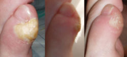 Dinners Ready!...Tofu with a side callus.jpg